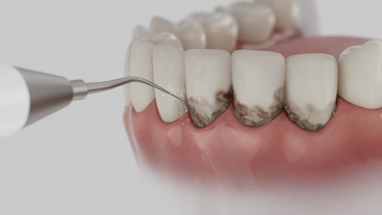 Reliable Root Canal Treatment contractor in Roundup, MT by Smile Center Dentistry